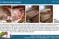 testimonial-Eczema3